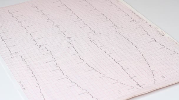 Médico Cardiólogo Despegar Poner Mesa Con Cardiograma Fonendoscopio Estetoscopio Concepto — Vídeos de Stock