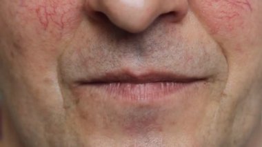 Kötü dişli adam konuşuyor, gülümsüyor ve gülüyor. Sigara içen hasta dişlerin videosunu kapat.