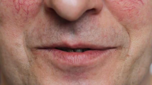 悪い歯を持つ男は 笑顔と笑って話している 喫煙者の病気の歯のビデオを閉じる — ストック動画