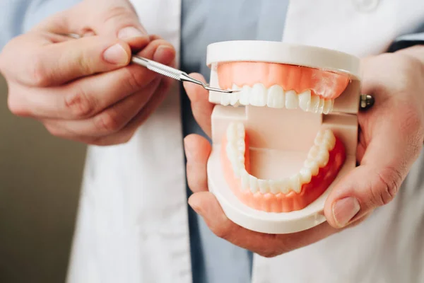 Dentysta Pokazuje Model Szczęki Narzędzia Dentystyczne Zbliżenie Koncepcja Opieki Ustnej — Zdjęcie stockowe