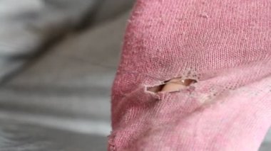 Kadın pembe çoraplarda delikler açıyor. El yapımı dikiş. Yoksulluk ve dilencilik kavramı. 