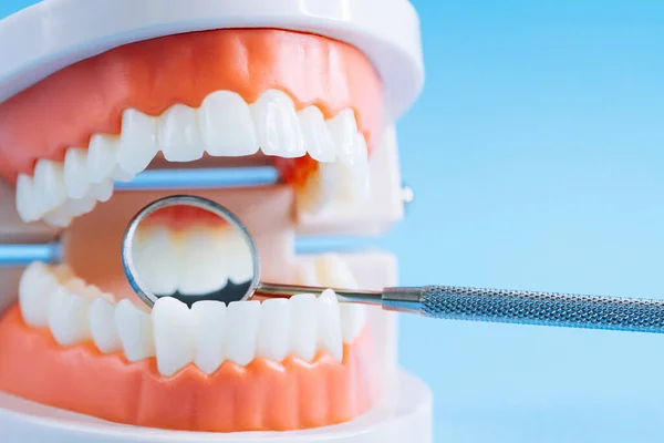 Zamknij Makro Pęd Modelu Zębów Lustrem Dentystycznym Niebieskim Tle Koncepcja — Zdjęcie stockowe