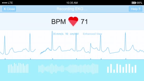 Simulierter Bildschirm der ekg-Aufnahme — Stockvideo