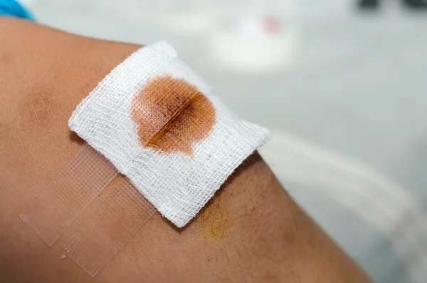 Clamp Out Cotton Wool Wound Knee — Stock Photo, Image