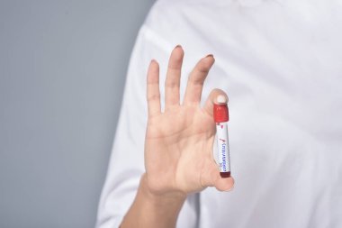 Hemşire hızla yayılan Coronavirus için pozitif kan testi sonuçlarını tutuyor.