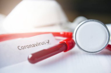 Coronavirus Laboratuvarı test listesindeki 2019-nCoV ve Coronavirus kan testi tıbbi form, maske, dokümanlardaki kan tüpleri stetoskop testleri 