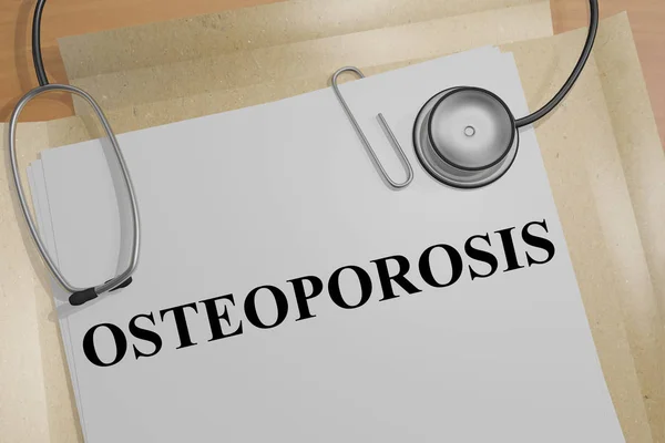 Osteoporose - medische concept — Stockfoto