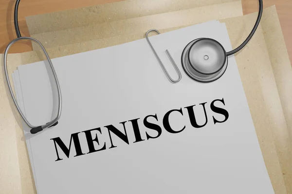 Menisküs - tıp kavramı — Stok fotoğraf