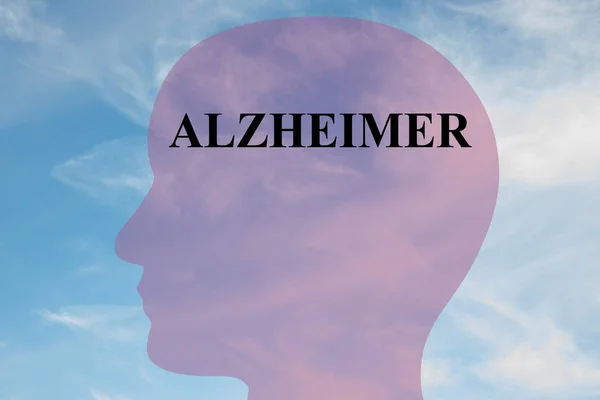 Alzheimer - concepto neurológico — Foto de Stock