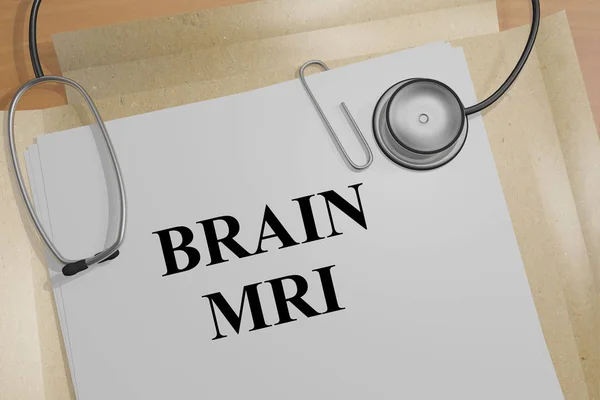 Mri - medyczną koncepcję mózgu — Zdjęcie stockowe