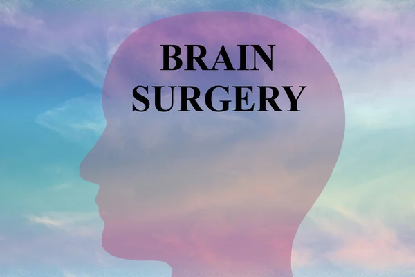 Brain Surgery - konsep medis — Stok Foto