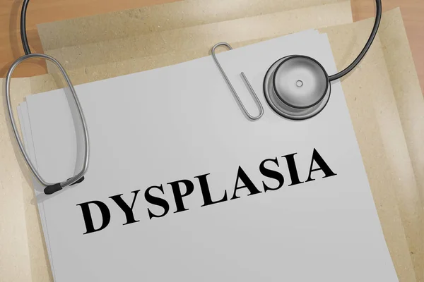 Displasia - concepto médico — Foto de Stock