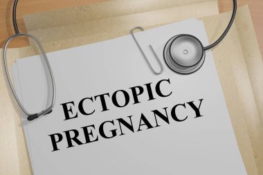 Ectopic Pregnancy - medical concept clipart