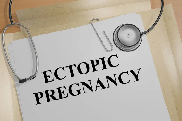 Ectopic Pregnancy - medical concept — Stock Photo, Image