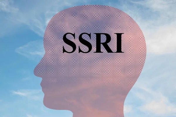 ISRS - concepto neuronal — Foto de Stock