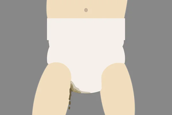 Ilustracja z przecieka diaper Baby — Zdjęcie stockowe