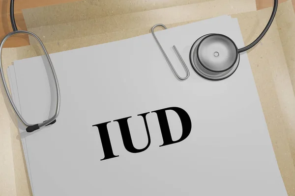 IUD - koncepcja ginekologiczne — Zdjęcie stockowe
