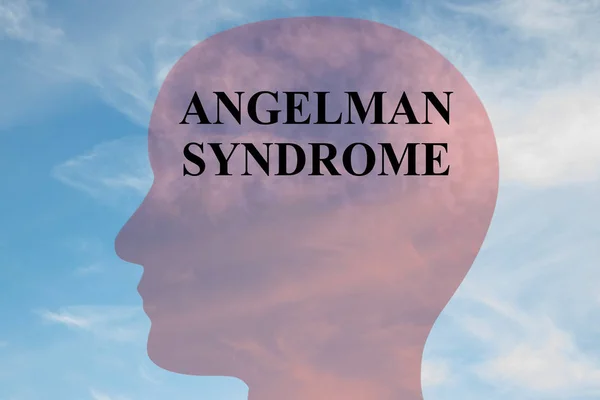Angelman-szindróma fogalma — Stock Fotó