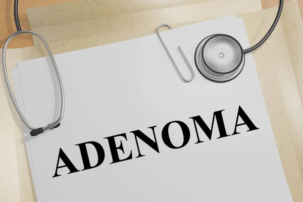 Ilustración Del Título Adenoma Documento Médico — Foto de Stock