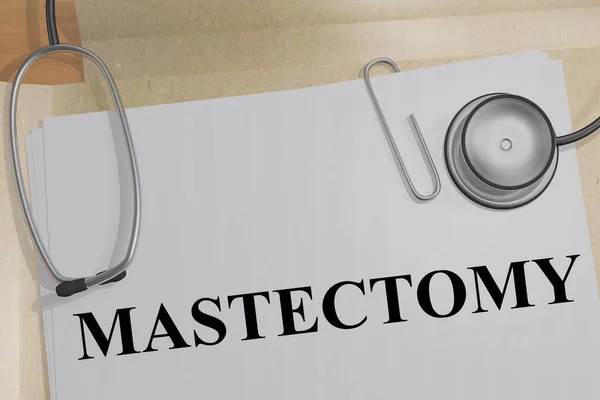 Ilustrace Titulu Mastectomy Lékařském Dokumentu — Stock fotografie