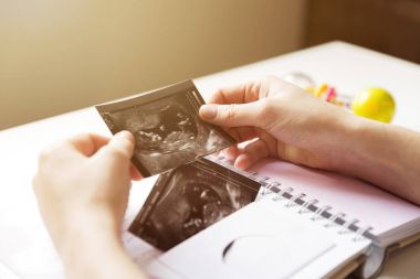 Bebeğin sonogram bebeğin ilk yıl hatıra defterine yerleştirerek kadın