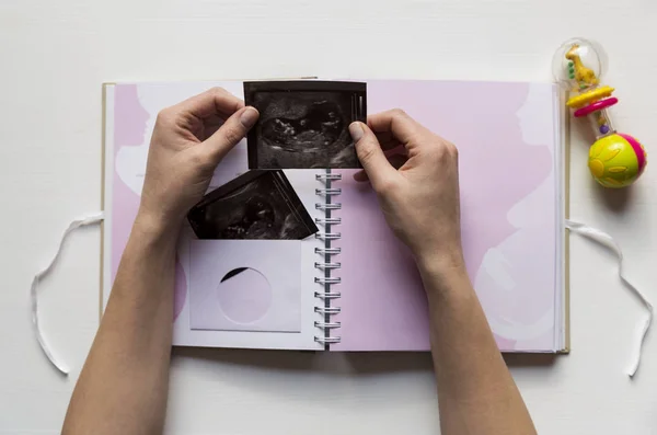 Frau platziert Sonogramm des Babys in Erinnerungsbuch für das erste Lebensjahr — Stockfoto