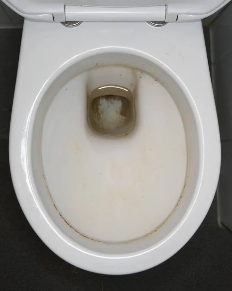 Brudna toaleta bowl — Zdjęcie stockowe
