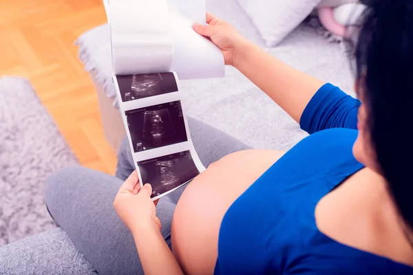 妊娠中の女性見ますザ超音波プリントの彼女の生まれていない赤ちゃん — ストック写真