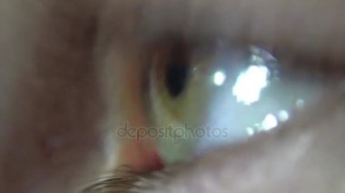 kadın gözü yeşil yanıp sönüyor