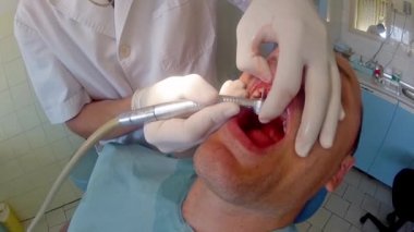 Dişçi işyerinde yetişkin erkek hastanın diş implant için hazırlanıyor