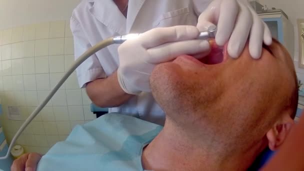 Dentista Trabajo Preparando Los Dientes Del Hombre Adulto Paciente Para — Vídeo de stock