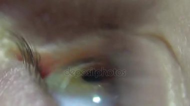 kadın gözü yeşil yanıp sönüyor