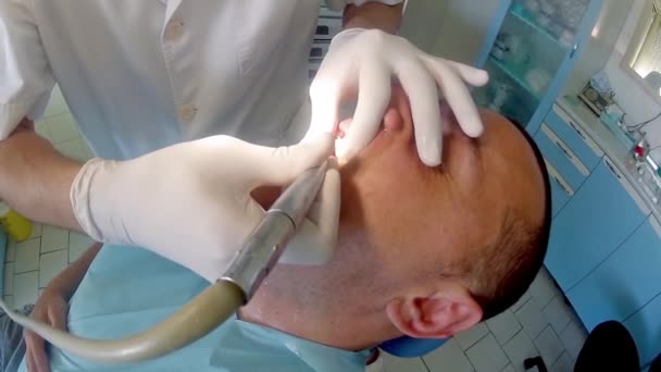 Dentist Work Preparing Teeth Adult Man Patient Implant — Stock Video