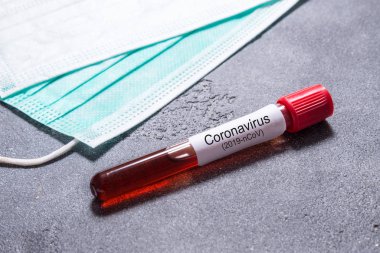 Wuhan Coronavirus virüsü taşıyan kan testi tüpü.