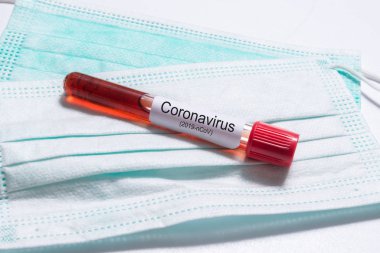 Wuhan Coronavirus virüsü taşıyan kan testi tüpü.