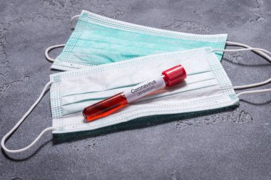 Wuhan Coronavirus virüsü taşıyan kan testi tüpü.