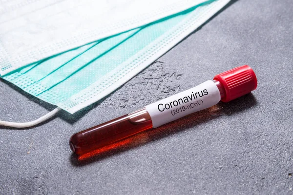 Wuhan Coronavirus virüsü taşıyan kan testi tüpü.