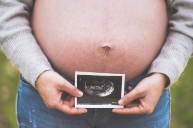 Hamile bir kadın bebeğinin açık havada çekilmiş bir fotoğrafını tutuyor..