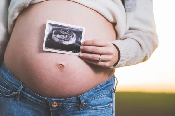 Una donna incinta sta tenendo una foto del suo bambino Ultrasuoni, all'aperto . — Foto Stock