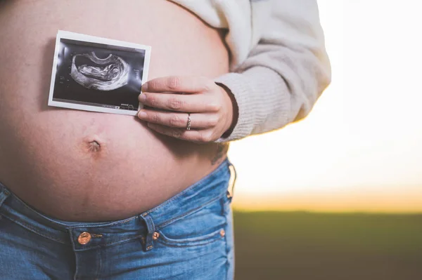 Una donna incinta sta tenendo una foto del suo bambino Ultrasuoni, all'aperto . — Foto Stock