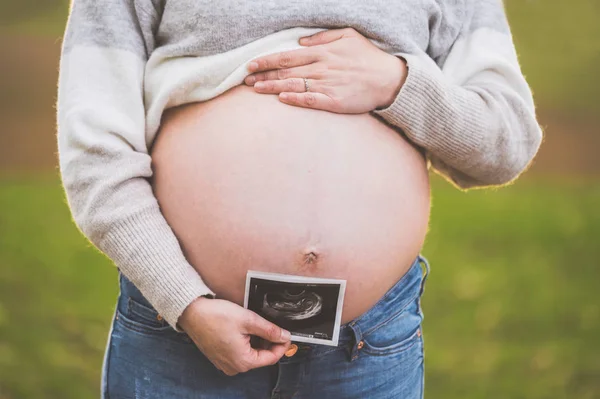 Беременная женщина держит фотографию своего ребенка УЗИ на улице . — стоковое фото