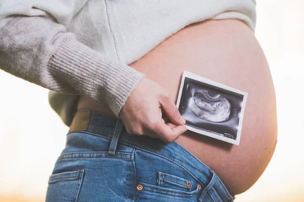 Een zwangere vrouw houdt een foto van haar baby echografie, buiten. — Stockfoto