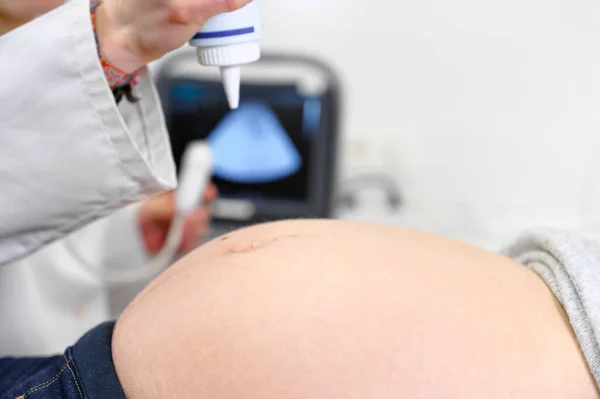 Doctor does Ultrasound or Sonogram Procedure to a Pregnant Woman in the Hospital, Close-up Shot of the Obstetrician Moving Transducer on the Belly of the Future Mother. — Stock Photo, Image