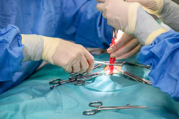 Nahaufnahme, Hände des professionellen Chirurgen, Operation. Im Hintergrund moderner Krankenhaus-Operationssaal. — Stockfoto