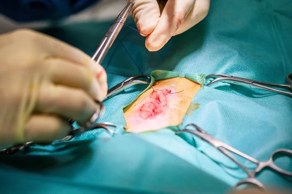 Műtéti eljárás egy betegen. Sebészek kezek védőkesztyűben, akik orvosi eszközökkel végeznek műtétet. — Stock Fotó