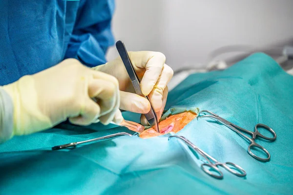 Close-up, Mãos do Cirurgião Profissional, fazendo cirurgia. No fundo Sala de Operação Hospitalar Moderna . — Fotografia de Stock