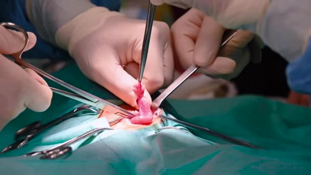 Proceso de operación en un paciente. Cirujanos manos en guantes protectores haciendo cirugía con herramientas médicas . — Vídeos de Stock