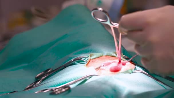 Χειρουργοί ομάδα χέρια εκτέλεση χειρουργικής επέμβασης. Κοντινό πλάνο. — Αρχείο Βίντεο