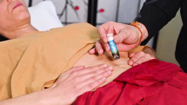 Alternatif terapist moxibustion uyguluyor geleneksel Çin tıbbı metodu. — Stok video