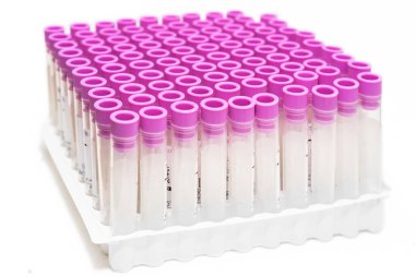 Covid-19 salgın kan testi. Coronavirus hastalarının kan örnekleri için boş test tüplerine yakından bakın..